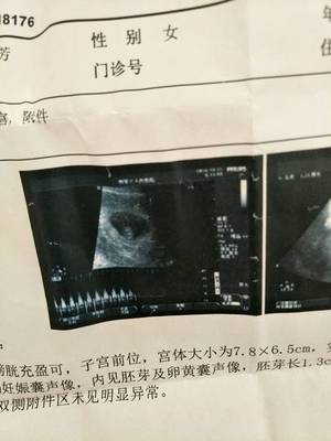 一般怀孕多久有心跳