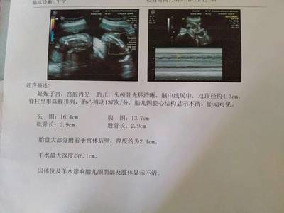 5个月怎么流产