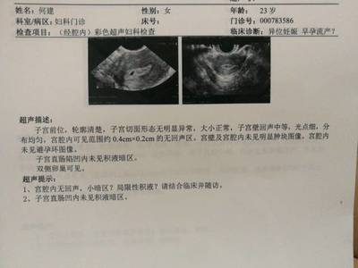 怀孕后要做什么检查