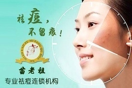 龙岗看痘痘