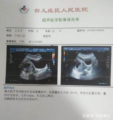 怀孕七周的症状和表现