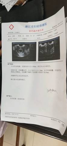怀孕40天能看出男女吗