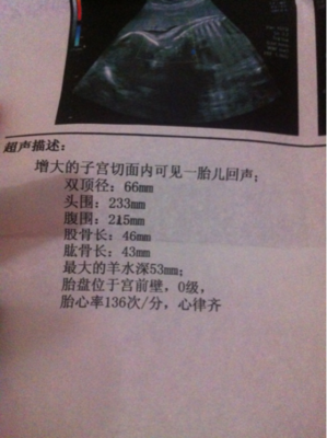 胎儿头围腹围