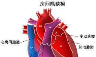 动脉扩张怎么治疗