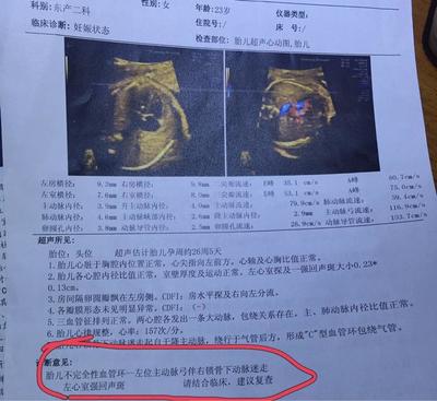 过几天能查出是否怀孕