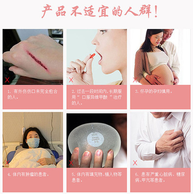 孕妇能用射频美容仪吗