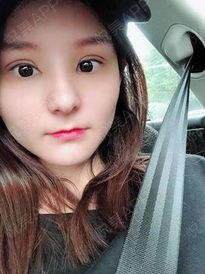 双眼皮拆完线注意事项