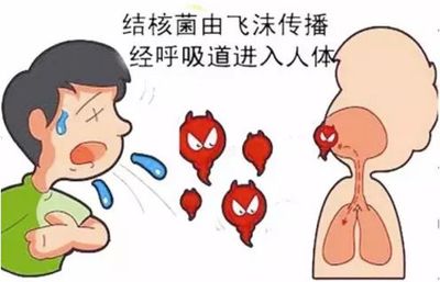 咳嗽有血丝