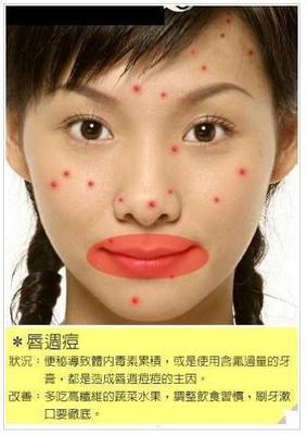 唇周痘痘用什么治疗方法