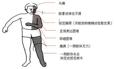 走路走不稳是怎么回事