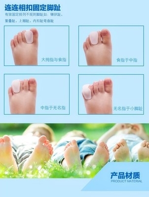 宝宝脚趾重叠图片