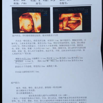 宝宝做核磁共振