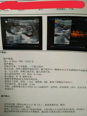 怀孕12周能做人流吗