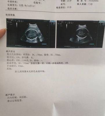 怀孕去检查要多少钱