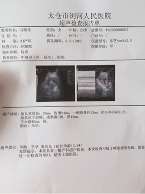 怀孕三个月怎么看男女