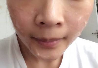 压缩面膜怎么用祛痘