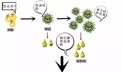 吃什么东西好不长痘痘