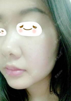脸过敏用什么化妆品好