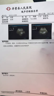 怀孕五周肚子疼是怎么回事