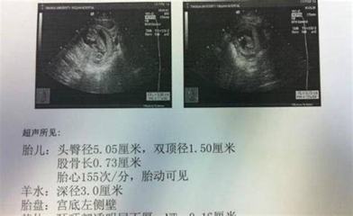 胎儿几个月发育听力