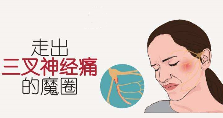 三叉神经疼是怎么回事