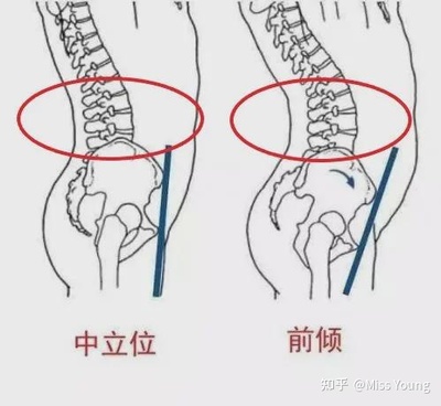 后腰窝疼是怎么回事