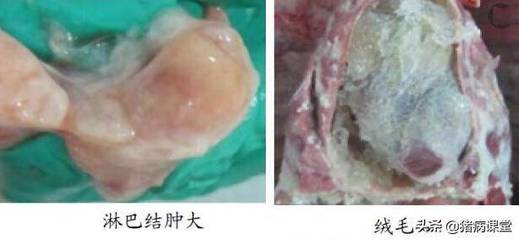 肠道淋巴结肿大是怎么回事