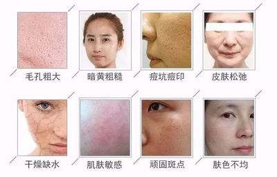 脸上皮肤毛孔粗大怎么办