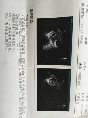 怀孕四十天彩超图片