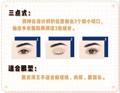 点式双眼皮