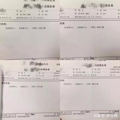 尿常规检查白细胞正常是多少算正常值