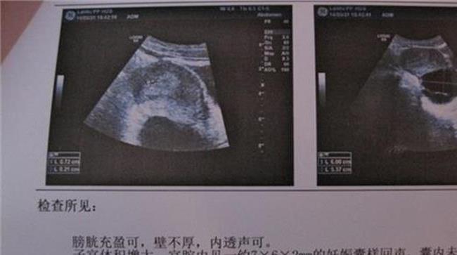 怀孕多少周开始入盆