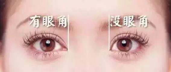 内眦开眼角