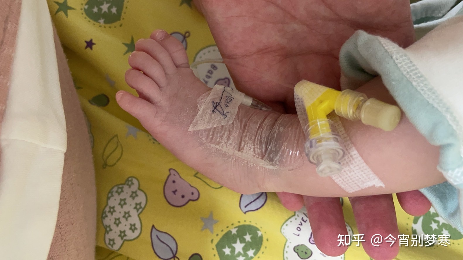 11个月的宝宝咳嗽有痰怎么办