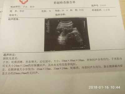 怀孕6周彩超图片