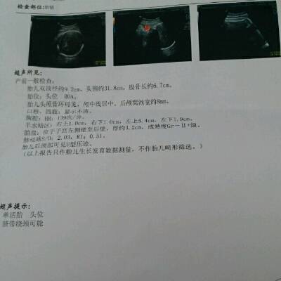 怀孕36周孩子一般几斤