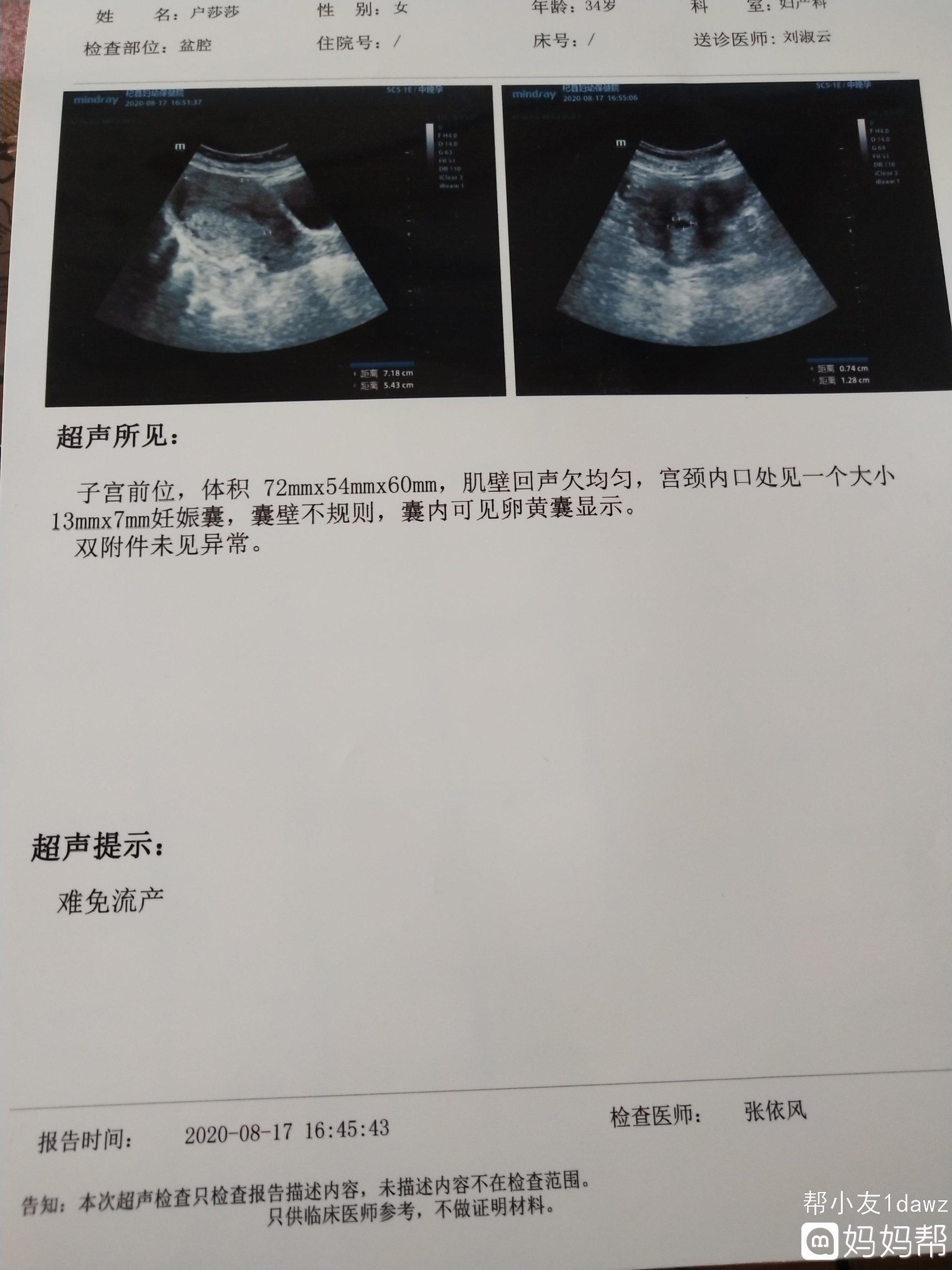 怀孕五周见红怎么回事