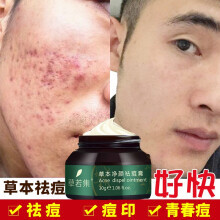 男士去痘痘药膏哪个好