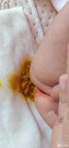 宝宝总是拉奶瓣怎么办