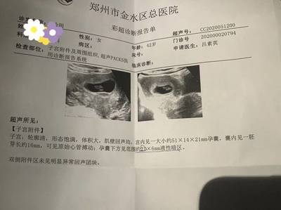 怀孕半个月会流产吗
