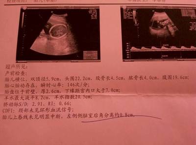 怀孕六个月胎儿有几斤