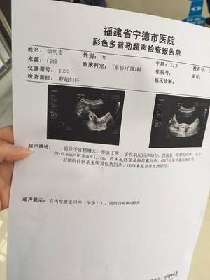 怀孕6周彩超图片