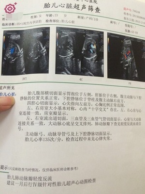 胎儿心脏检查
