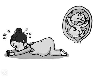 怀孕臀位怎么办