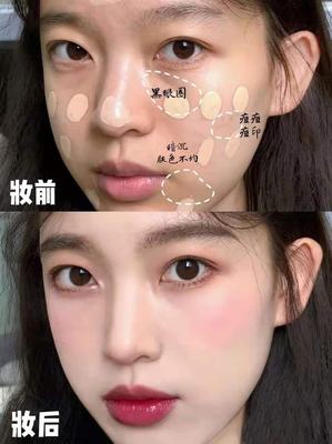 熬夜是不是爱起痘痘