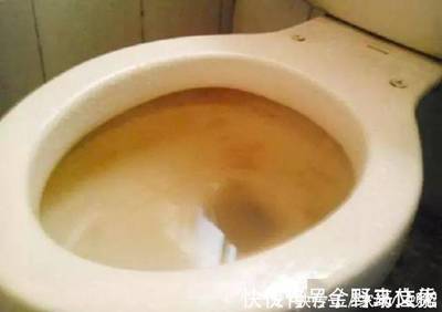 马桶黑色污垢怎么去除