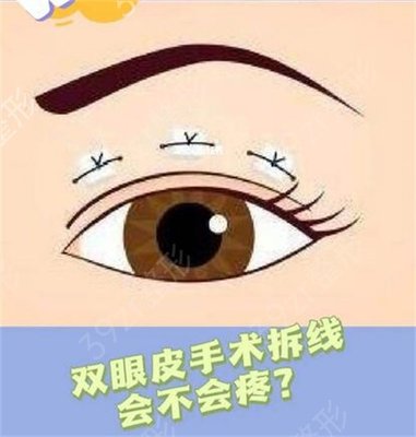 双眼皮纳米技术