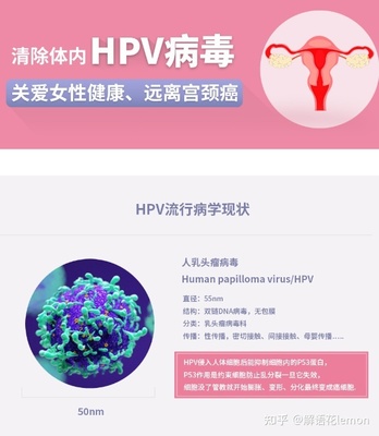 宫颈高危病毒怎么治疗