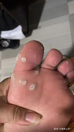 脚麻麻的是怎么回事