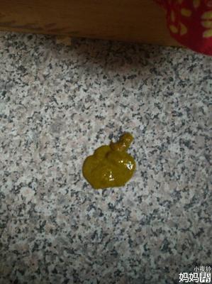 大便很粘稠是怎么回事